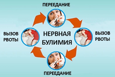 Лечение булимии в Свердловске